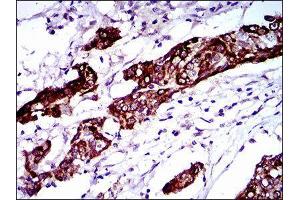 Immunohistochemistry (IHC) image for anti-Breast Cancer 1 (BRCA1) (AA 229-335) antibody (ABIN1846101) (BRCA1 抗体  (AA 229-335))
