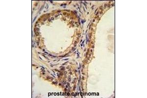 Immunohistochemistry (Paraffin-embedded Sections) (IHC (p)) image for anti-CAMP Responsive Element Binding Protein 3-Like 1 (CREB3L1) (AA 481-509), (C-Term) antibody (ABIN390517)