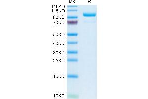 Complement C2 Protein (AA 21-752) (His tag)