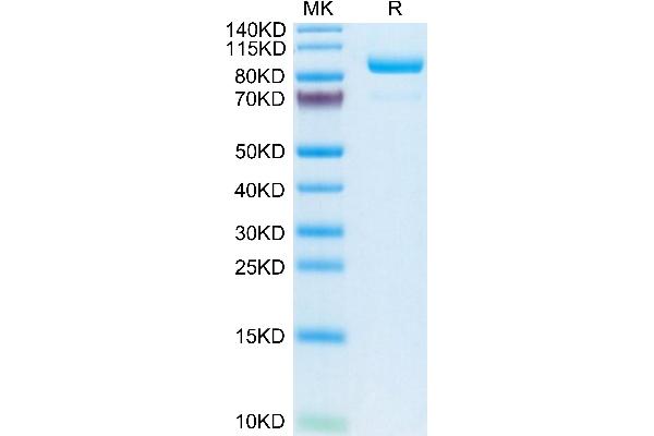 Complement C2 Protein (AA 21-752) (His tag)