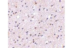 Immunohistochemistry of CAPS1 in human brain with CAPS1 antibody at 5 μg/ml. (CADPS 抗体  (N-Term))