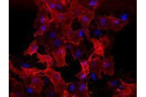 Immunofluorescence (IF) image for anti-VEGF Receptor 2 (VEGFR2) antibody (ABIN2664545) (VEGFR2/CD309 抗体)