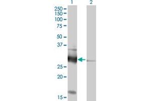 Western Blot analysis of VAPB expression in transfected 293T cell line by VAPB MaxPab polyclonal antibody. (VAPB 抗体  (AA 1-243))
