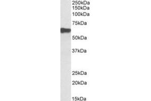 Western Blotting (WB) image for anti-Myotilin (MYOT) (AA 209-221), (Internal Region) antibody (ABIN1449481) (Myotilin 抗体  (Internal Region))