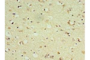 Immunohistochemistry of paraffin-embedded human brain tissue using ABIN7149474 at dilution of 1:100 (DRD3 抗体  (AA 213-329))