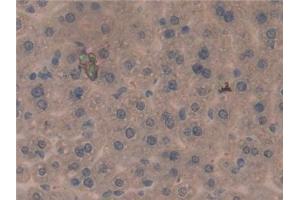 Detection of PDL1 in Mouse Liver Tissue using Polyclonal Antibody to Programmed Cell Death Protein 1 Ligand 1 (PDL1) (PD-L1 抗体  (AA 34-241))