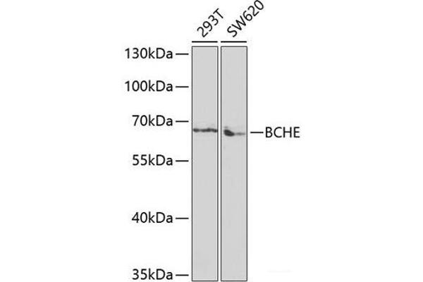 Butyrylcholinesterase 抗体