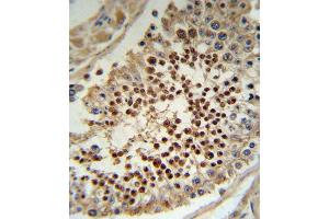 Immunohistochemistry (IHC) image for anti-Kruppel-Like Factor 5 (Intestinal) (KLF5) antibody (ABIN3003155) (KLF5 抗体)