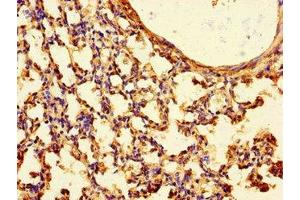 Immunohistochemistry of paraffin-embedded human lung tissue using ABIN7165823 at dilution of 1:100 (TTLL8 抗体  (AA 671-822))