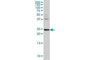 PCMT1 monoclonal antibody (M02), clone 1D6 Western Blot analysis of PCMT1 expression in HeLa .