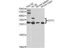 Western blot analysis of extracts of various cell lines, using GYPC antibody (ABIN5970574) at 1/1000 dilution. (CD236/GYPC 抗体)