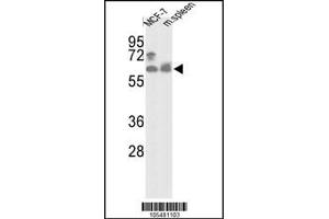 Western blot analysis of hPANK1-R90 in MCF-7 cell line and mouse spleen tissue lysates (35ug/lane) (PANK1 抗体  (N-Term))