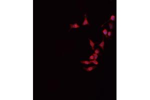 ABIN6266517 staining HeLa cells by IF/ICC. (Connexin 43/GJA1 抗体  (Internal Region))
