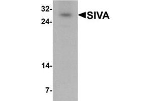 Western blot analysis of SIVA in mouse liver tissue lysate with SIVA antibody at 1 ug/mL.