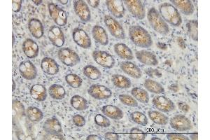Immunostaining (ISt) image for anti-Exocyst Complex Component 7 (EXOC7) (AA 586-684) antibody (ABIN565033)
