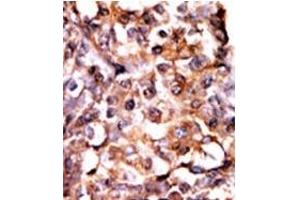 Image no. 2 for anti-Mitogen-Activated Protein Kinase-Activated Protein Kinase 2 (MAPKAPK2) (pSer272) antibody (ABIN358152) (MAPKAP Kinase 2 抗体  (pSer272))