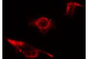 ABIN6274581 staining 293 cells by IF/ICC. (ADD2 抗体  (Internal Region))