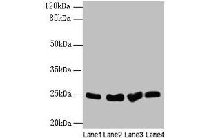 Western blot All lanes: Socs3 antibody at 12 μg/mL Lane 1: K562 whole cell lysate Lane 2: A375 whole cell lysate Lane 3: Hela whole cell lysate Lane 4: HepG2 whole cell lysate Secondary Goat polyclonal to rabbit IgG at 1/10000 dilution Predicted band size: 25 kDa Observed band size: 25 kDa (SOCS3 抗体  (AA 1-225))