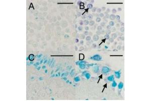 IHC staining for viral capsid protein with ABIN1000236: (A) Uninfected HeLa cells, (B) HRV16-infected HeLa cells, (C) Negative bronchial biopsy section, (D) Positive bronchial biopsy section. (Rhinovirus 16 抗体)