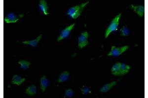 Immunofluorescence staining of U251 cells with ABIN7140169 at 1:50, counter-stained with DAPI. (TJP1 抗体  (AA 116-138))