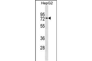 Western blot analysis in HepG2 cell line lysates (35ug/lane). (ZNF614 抗体  (AA 174-200))