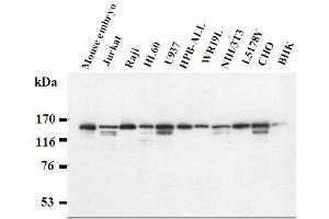 Western Blotting (WB) image for anti-Splicing Factor 3b, Subunit 1, 155kDa (SF3B1) antibody (ABIN1449178) (SF3B1 抗体)