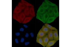 ABIN7096271 and ABIN7100333 staining Hela cells(30 min of UV treatment) by IF/ICC. (RNF145 抗体)