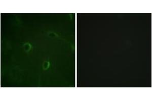 Immunofluorescence (IF) image for anti-Insulin Receptor (INSR) (AA 1326-1375) antibody (ABIN2888665) (Insulin Receptor 抗体  (AA 1326-1375))
