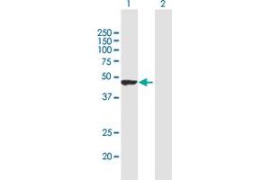 Western Blot analysis of TRIM62 expression in transfected 293T cell line by TRIM62 MaxPab polyclonal antibody. (TRIM62 抗体  (AA 1-475))