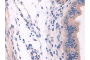 DAB staining on IHC-P; Samples: Mouse Uterus Tissue (NSP5 抗体  (AA 961-1063))