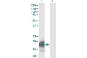 Western Blot analysis of CARHSP1 expression in transfected 293T cell line by CARHSP1 monoclonal antibody (M08), clone 4G10. (CARHSP1 抗体  (AA 1-147))