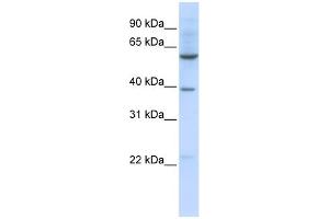 WB Suggested Anti-SLC35F3 Antibody Titration:  0. (SLC35F3 抗体  (Middle Region))