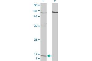 Western Blot analysis of PPBP expression in transfected 293T cell line by PPBP monoclonal antibody (M01), clone 3B9. (CXCL7 抗体  (AA 37-128))