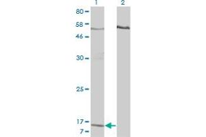 Western Blot analysis of PPBP expression in transfected 293T cell line by PPBP monoclonal antibody (M01), clone 3B9.