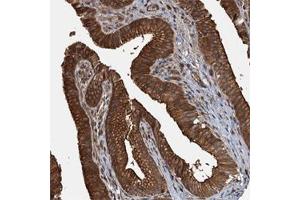 Immunohistochemical staining of human gallbladder with APOL5 polyclonal antibody  shows strong cytoplasmic and membranous positivity in glandular cells at 1:50-1:200 dilution. (Apolipoprotein L 5 抗体)