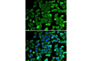 Immunofluorescence analysis of HeLa cells using SIRT2 antibody. (SIRT2 抗体)