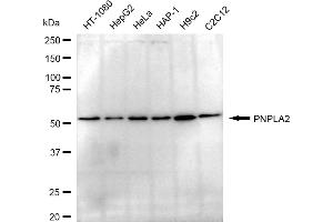 Western blotting analysis using PNPLA2 antibody (ABIN7799742).