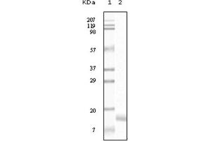 Western Blotting (WB) image for anti-Synuclein, gamma (Breast Cancer-Specific Protein 1) (SNCG) antibody (ABIN1107306) (SNCG 抗体)