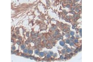 Used in DAB staining on fromalin fixed paraffin- embedded Kidney tissue (S100A16 抗体  (AA 1-97))