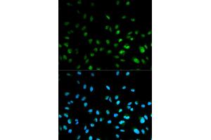 Immunofluorescence analysis of MCF-7 cells using HDAC3 antibody. (HDAC3 抗体)