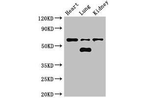 Western Blot Positive WB detected in: Mouse heart tissue, Mouse lung tissue, Mouse kidney tissue All lanes: CERK antibody at 3 μg/mL Secondary Goat polyclonal to rabbit IgG at 1/50000 dilution Predicted band size: 60, 38 kDa Observed band size: 60, 48 kDa (CERK 抗体  (AA 212-478))