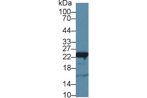 Western Blotting (WB) image for anti-Glutathione S-Transferase pi 1 (GSTP1) (AA 1-210) antibody (ABIN1078088)