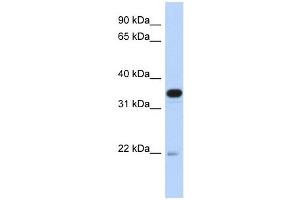 PITPNB antibody used at 1 ug/ml to detect target protein. (PITPNB 抗体  (Middle Region))