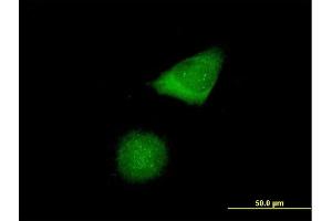 Immunofluorescence of purified MaxPab antibody to CENPH on HeLa cell. (CENPH 抗体  (AA 1-247))