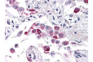 Human Lung: Formalin-Fixed, Paraffin-Embedded (FFPE) (EFHD1 抗体  (N-Term))