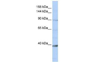 NCKAP1L antibody used at 0. (NCKAP1L 抗体  (N-Term))
