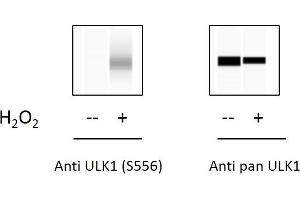 C2C12 cells were untreated or treated with 1mM H2O2 for 15 min. (ULK1 ELISA 试剂盒)