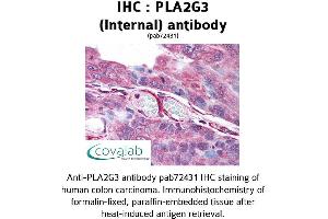 Image no. 1 for anti-Phospholipase A2, Group III (PLA2G3) (Internal Region) antibody (ABIN1738136) (PLA2G3 抗体  (Internal Region))