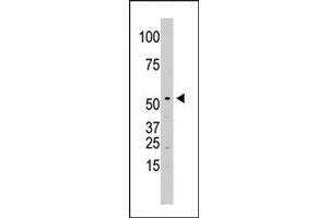 The SPPL2A polyclonal antibody  is used in Western blot to detect SPPL2A in Jurkat cell lysate. (SPPL2A 抗体  (N-Term))