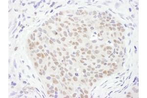 Immunohistochemistry (IHC) image for anti-Thymine-DNA Glycosylase (TDG) (AA 360-410) antibody (ABIN7455026) (TDG 抗体  (AA 360-410))